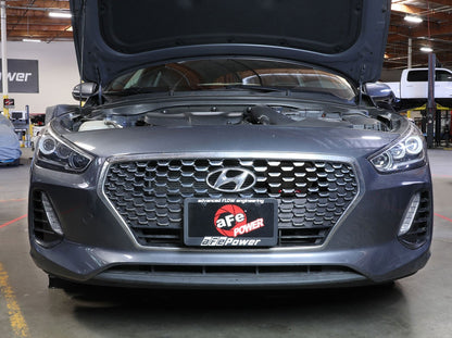 aFe Hyundai Elantra GT 18-20 L4-1.6L (t) Dynamic Air Scoop (D.A.S.) - 56-70005S aFe