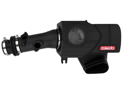 AFE Momentum Intake System w/ Pro Dry S Filter 2021+ Acura TLX aFe