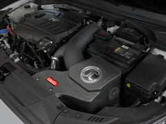 AFE Takeda Momentum Cold Air Intake System w/Pro DRY S Filter Hyundai Veloster N 19-20 - eliteracefab.com
